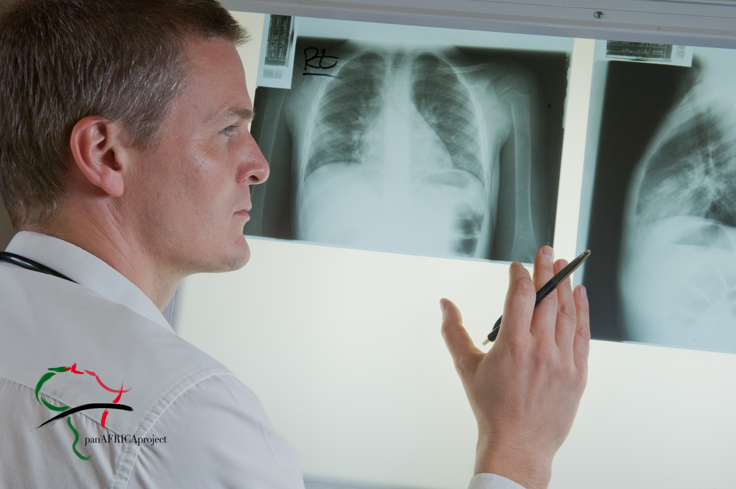 Doctor examines x-rays